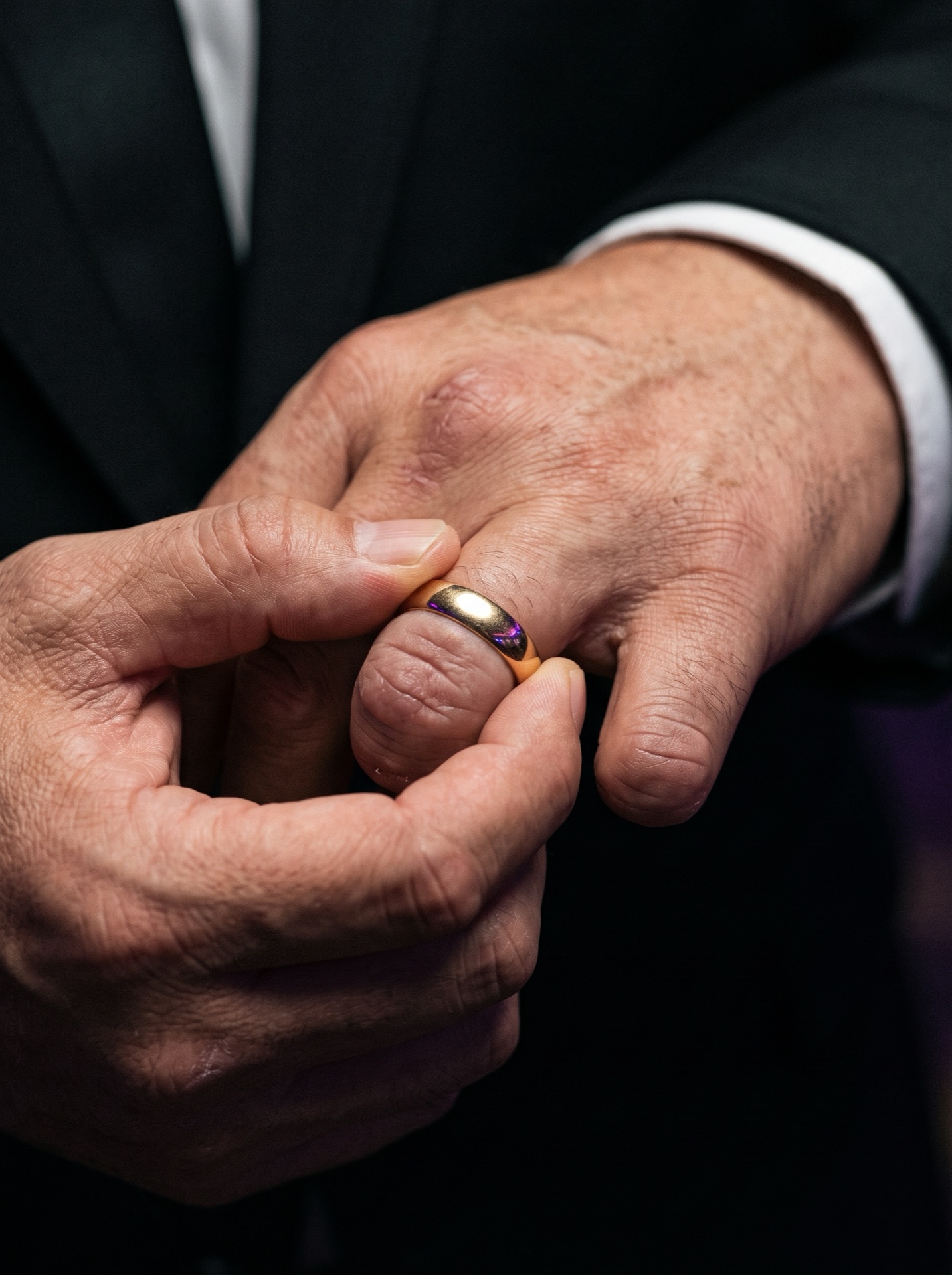 A gold wedding ring being forced onto an injured finger